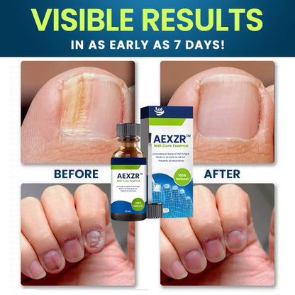 🔥Best seller worldwide!🔥AEXZR™ Nail Cure Essence