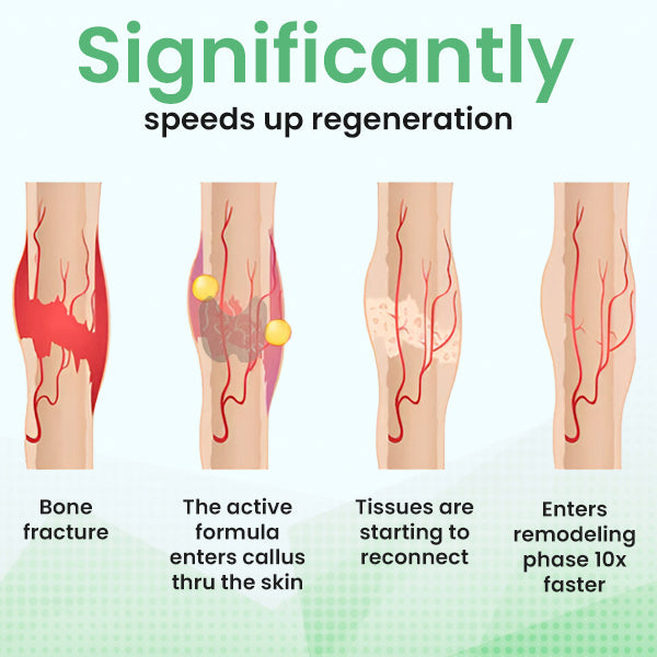 AEXZR™ Joints and Bone Therapy Plaster