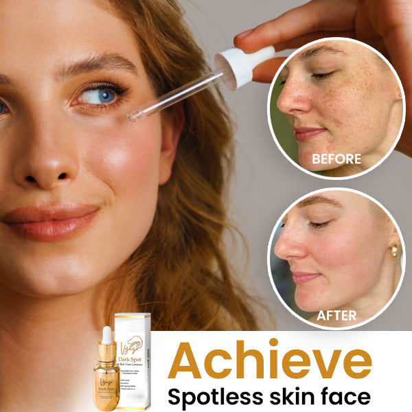 Vyuze™ Dark Spot and Skin Tone Corrector