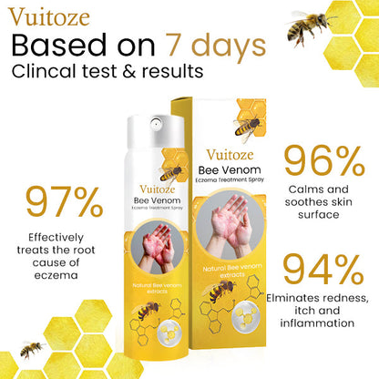 🏆✅FDA Endorsed🇺🇸 |🐝Vuitoze™ Bee Venom Eczema Treatment Spray