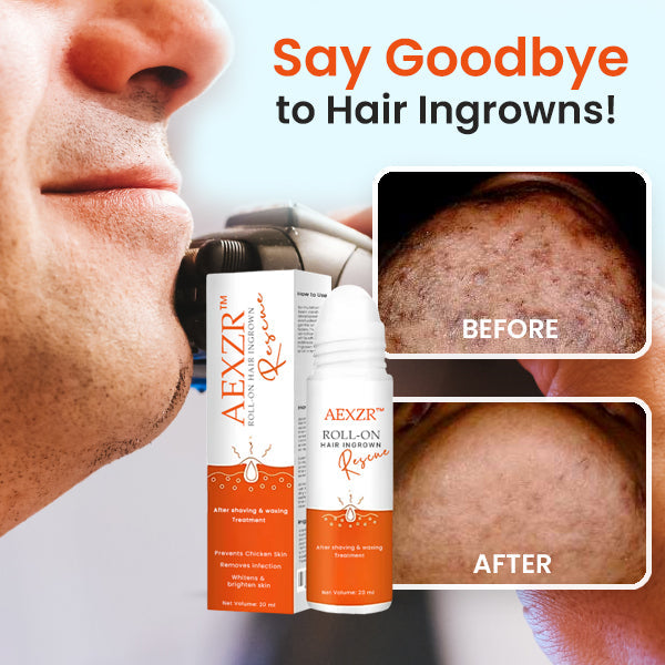 AEXZR™ Roll-On Hair Ingrown Rescue