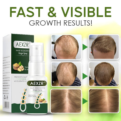 AEXZR™ Hair Regrowth Ginger Spray